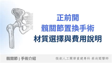 骨枯手術費用|【髖關節手術】即睇原理、副作用及詳細步驟+收費參。